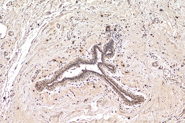 POLD3 Antibody in Immunohistochemistry (Paraffin) (IHC (P))