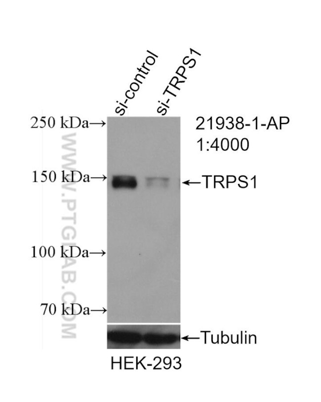 TRPS1 Antibody in Western Blot (WB)
