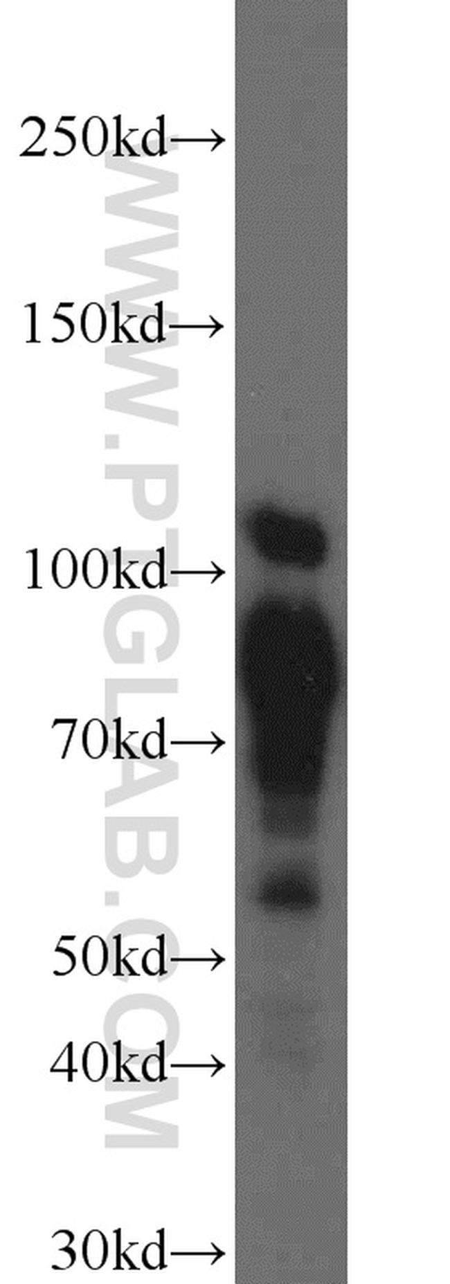 DNAJC6/AUXILIN Antibody in Western Blot (WB)