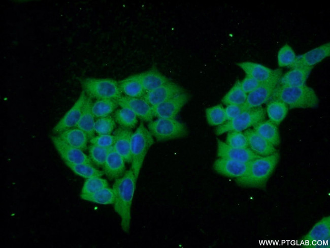 DNAJC6/AUXILIN Antibody in Immunocytochemistry (ICC/IF)