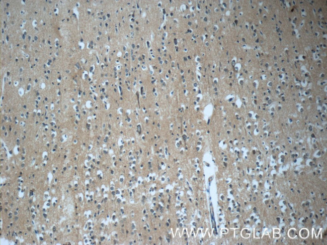 DNAJC6/AUXILIN Antibody in Immunohistochemistry (Paraffin) (IHC (P))