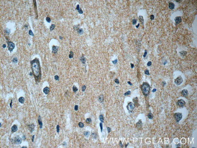 DNAJC6/AUXILIN Antibody in Immunohistochemistry (Paraffin) (IHC (P))