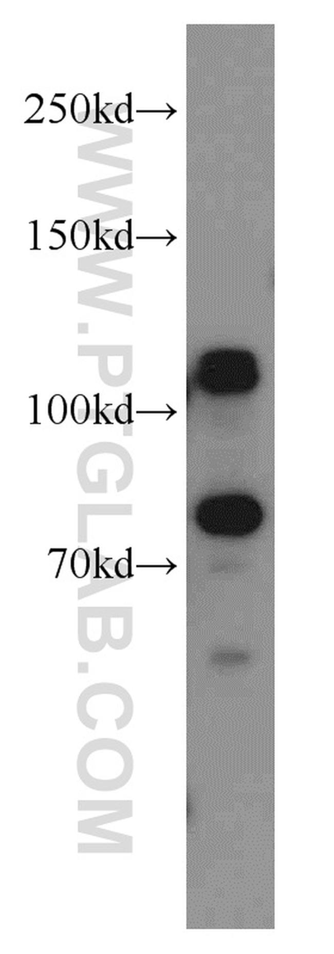 DNAJC6/AUXILIN Antibody in Western Blot (WB)
