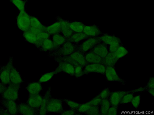 SH3BGRL2 Antibody in Immunocytochemistry (ICC/IF)