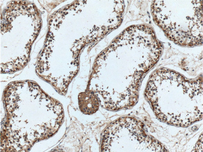 UCN Antibody in Immunohistochemistry (Paraffin) (IHC (P))