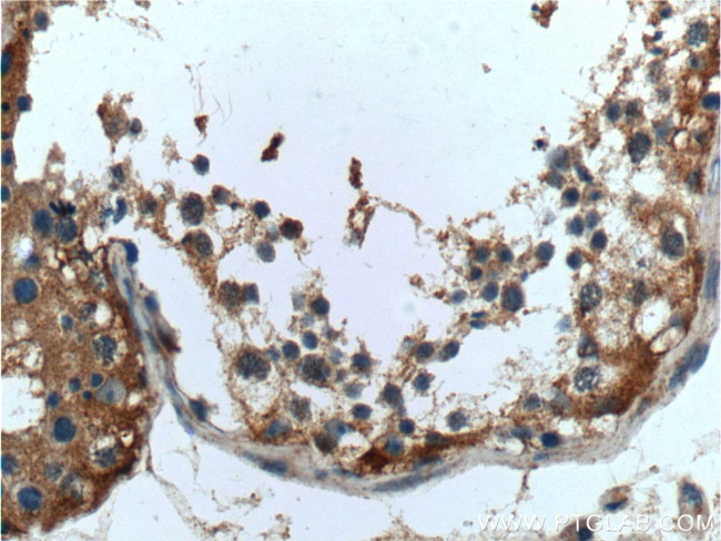 UCN Antibody in Immunohistochemistry (Paraffin) (IHC (P))