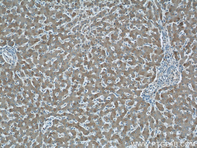 FTCD Antibody in Immunohistochemistry (Paraffin) (IHC (P))