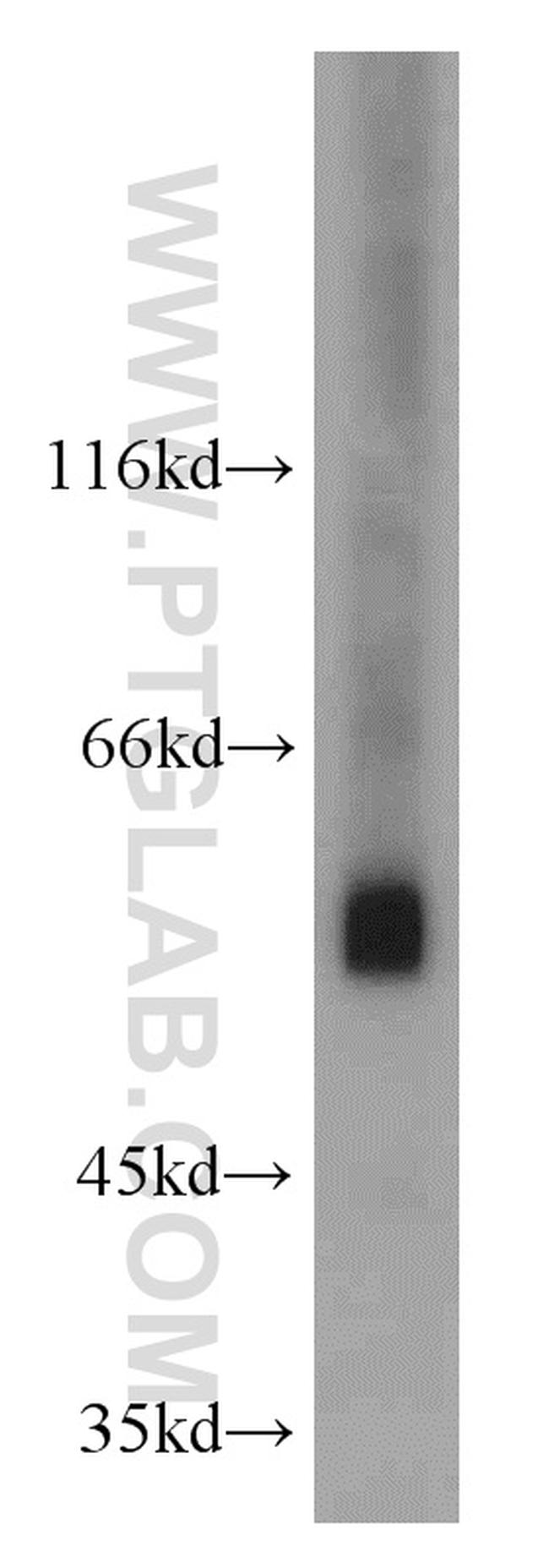 FTCD Antibody in Western Blot (WB)