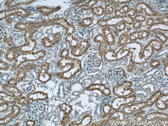 FTCD Antibody in Immunohistochemistry (Paraffin) (IHC (P))