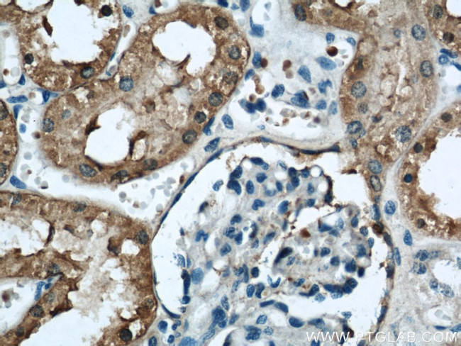 FTCD Antibody in Immunohistochemistry (Paraffin) (IHC (P))