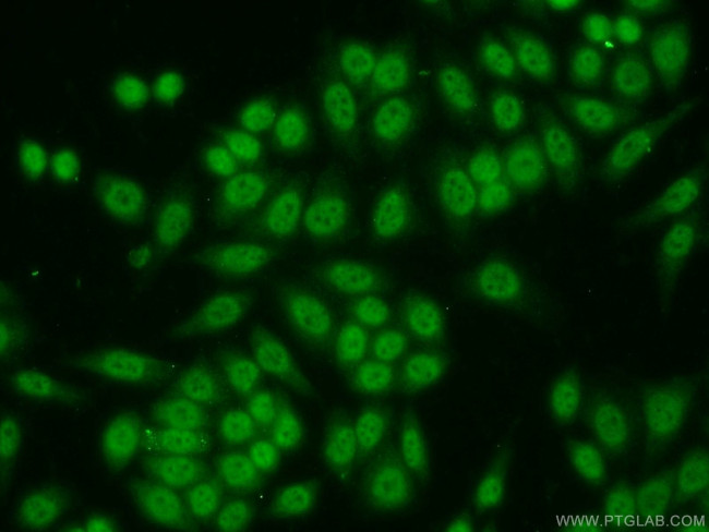 SP1 Antibody in Immunocytochemistry (ICC/IF)