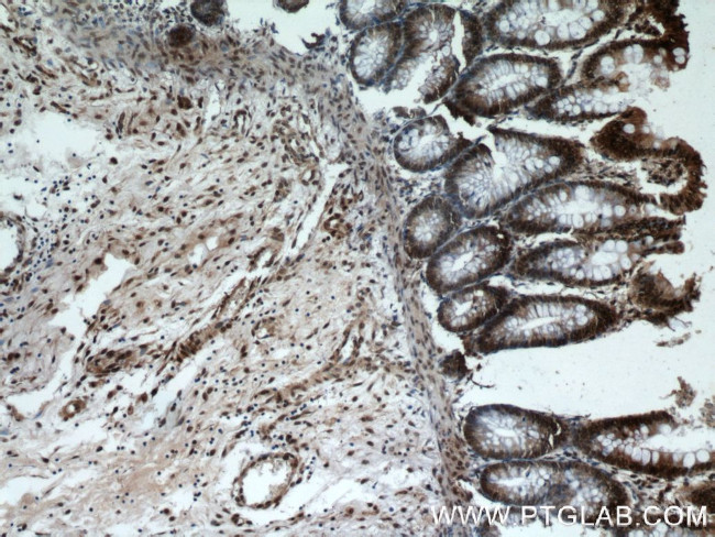 SP1 Antibody in Immunohistochemistry (Paraffin) (IHC (P))