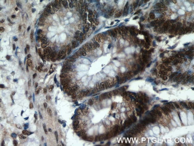 SP1 Antibody in Immunohistochemistry (Paraffin) (IHC (P))