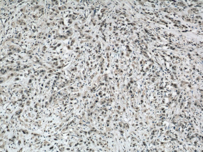 SP1 Antibody in Immunohistochemistry (Paraffin) (IHC (P))