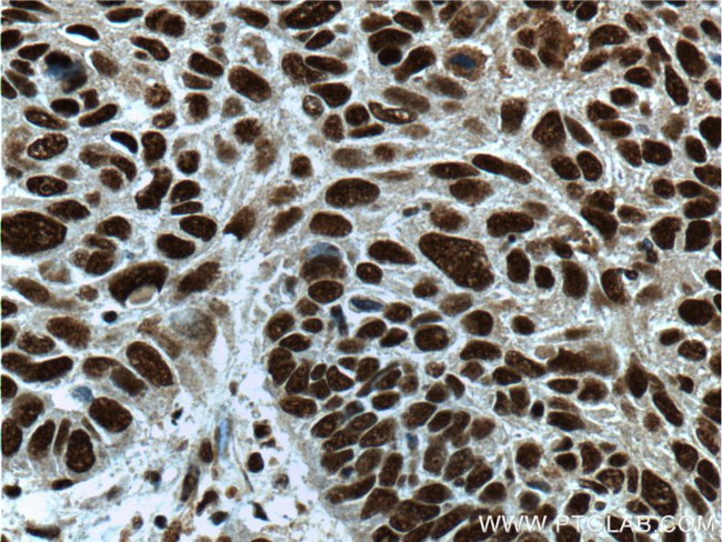 SP1 Antibody in Immunohistochemistry (Paraffin) (IHC (P))