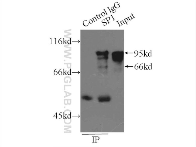 SP1 Antibody in Immunoprecipitation (IP)