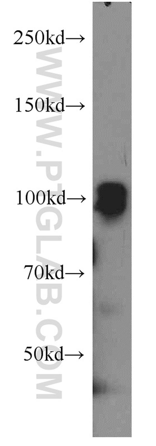 SP1 Antibody in Western Blot (WB)