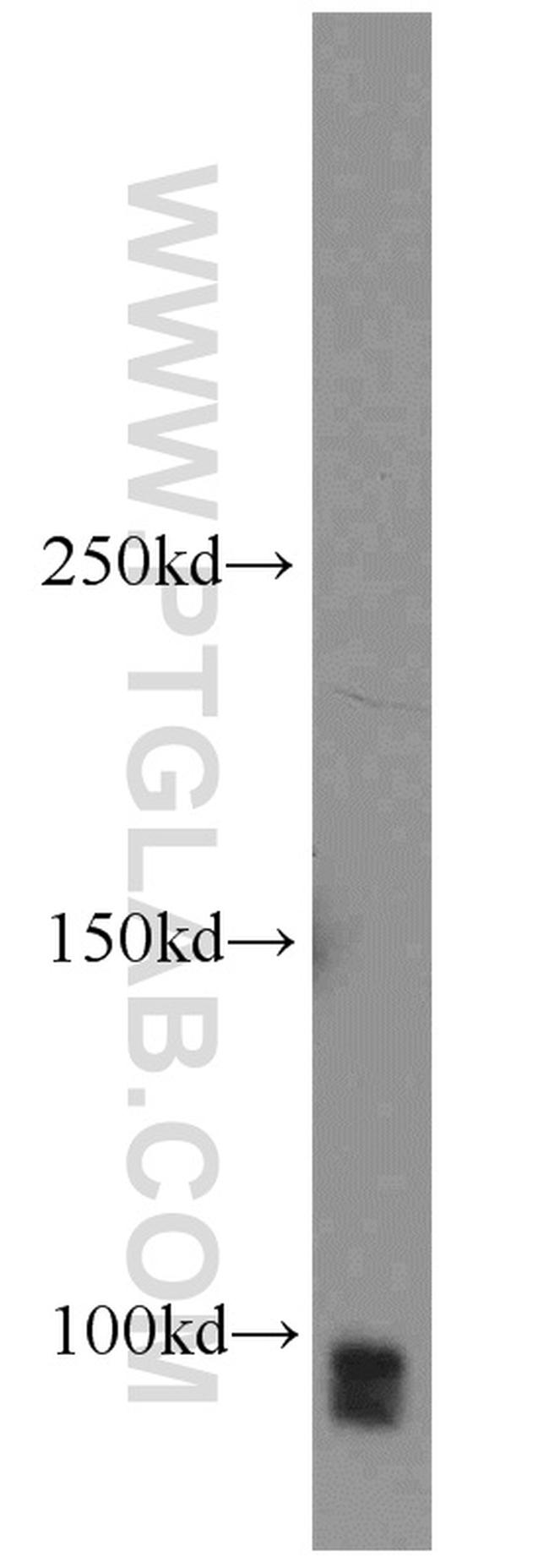 SP1 Antibody in Western Blot (WB)