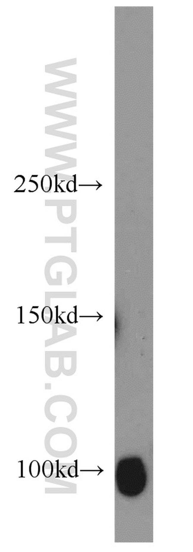 SP1 Antibody in Western Blot (WB)