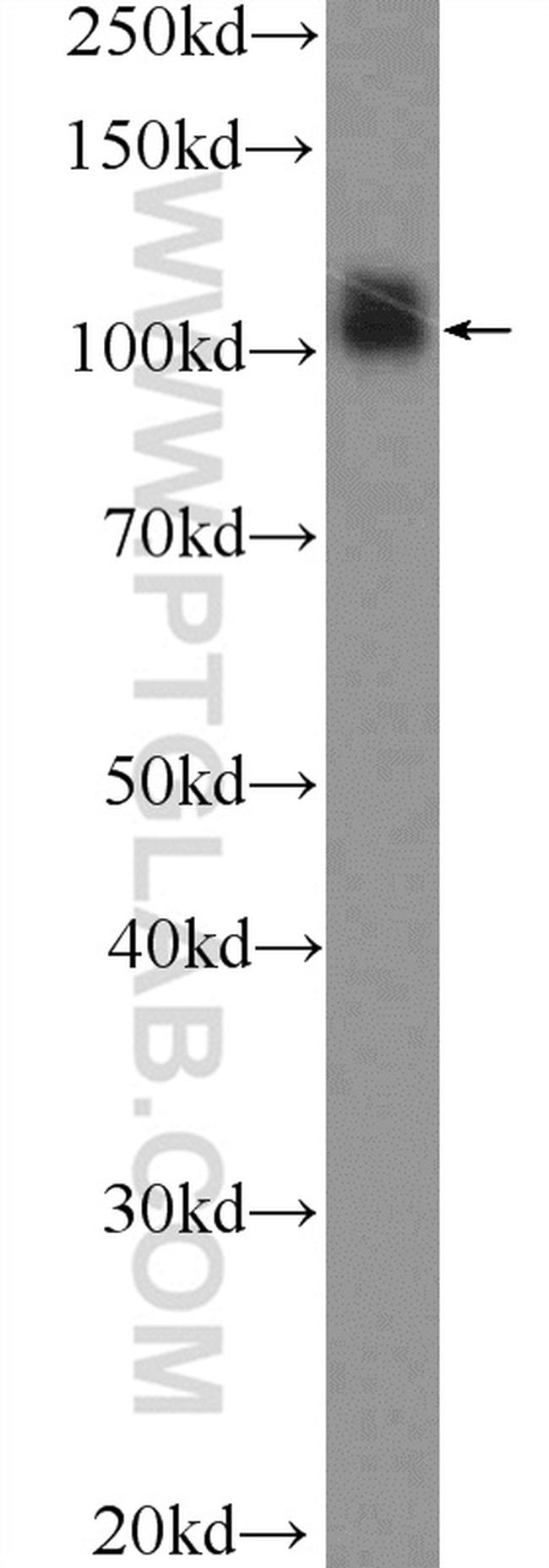 SP1 Antibody in Western Blot (WB)