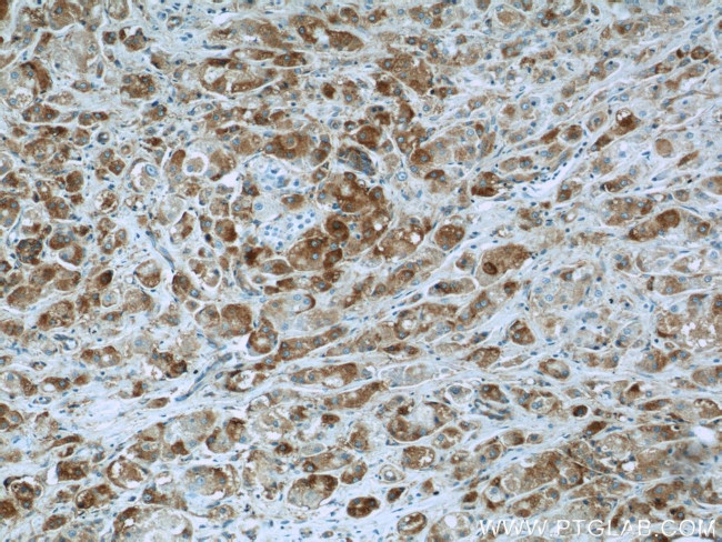 BCL2L12 Antibody in Immunohistochemistry (Paraffin) (IHC (P))