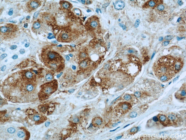 BCL2L12 Antibody in Immunohistochemistry (Paraffin) (IHC (P))