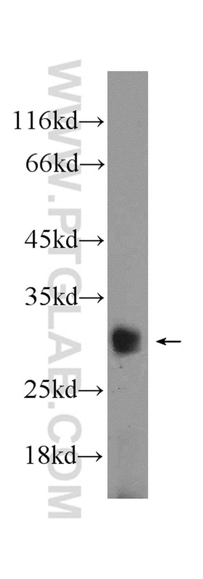 BCL2L12 Antibody in Western Blot (WB)