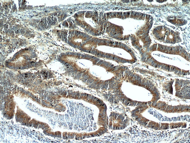 ALCAM Antibody in Immunohistochemistry (Paraffin) (IHC (P))