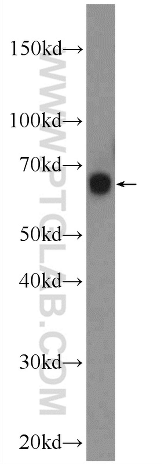 KLHL34 Antibody in Western Blot (WB)
