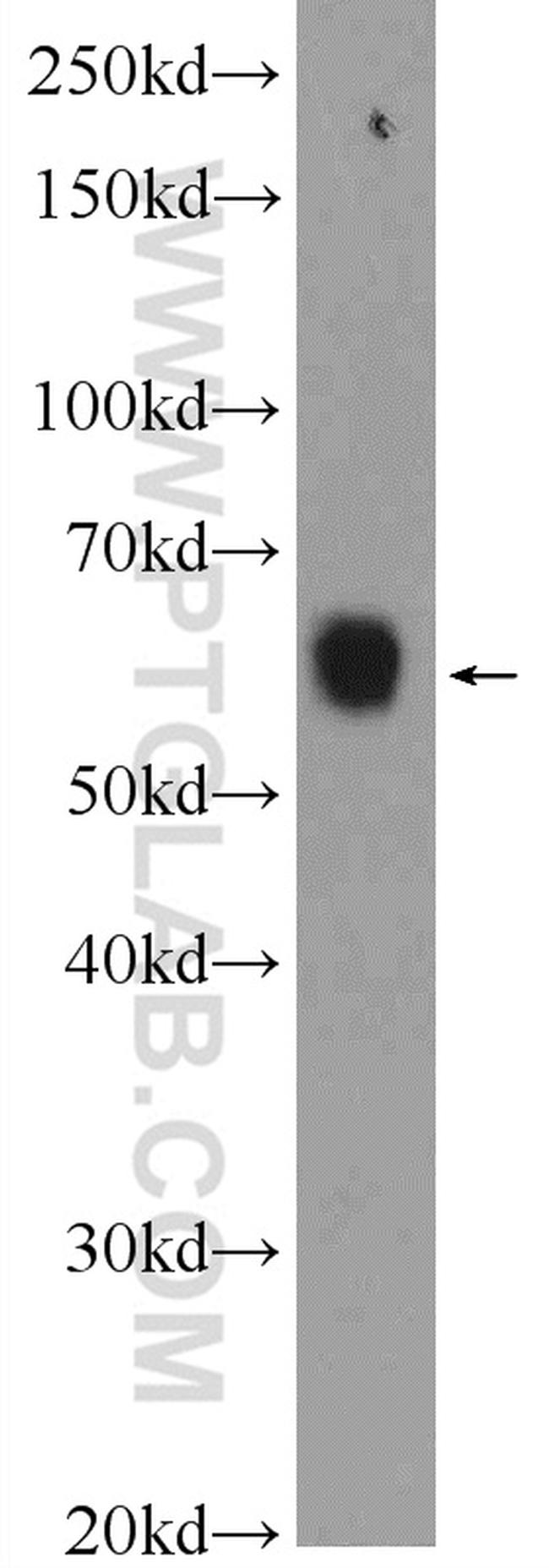 KLHL34 Antibody in Western Blot (WB)