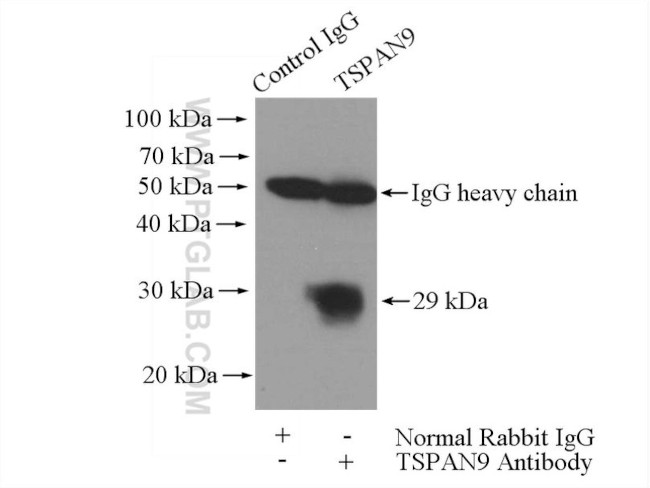 TSPAN9 Antibody in Immunoprecipitation (IP)