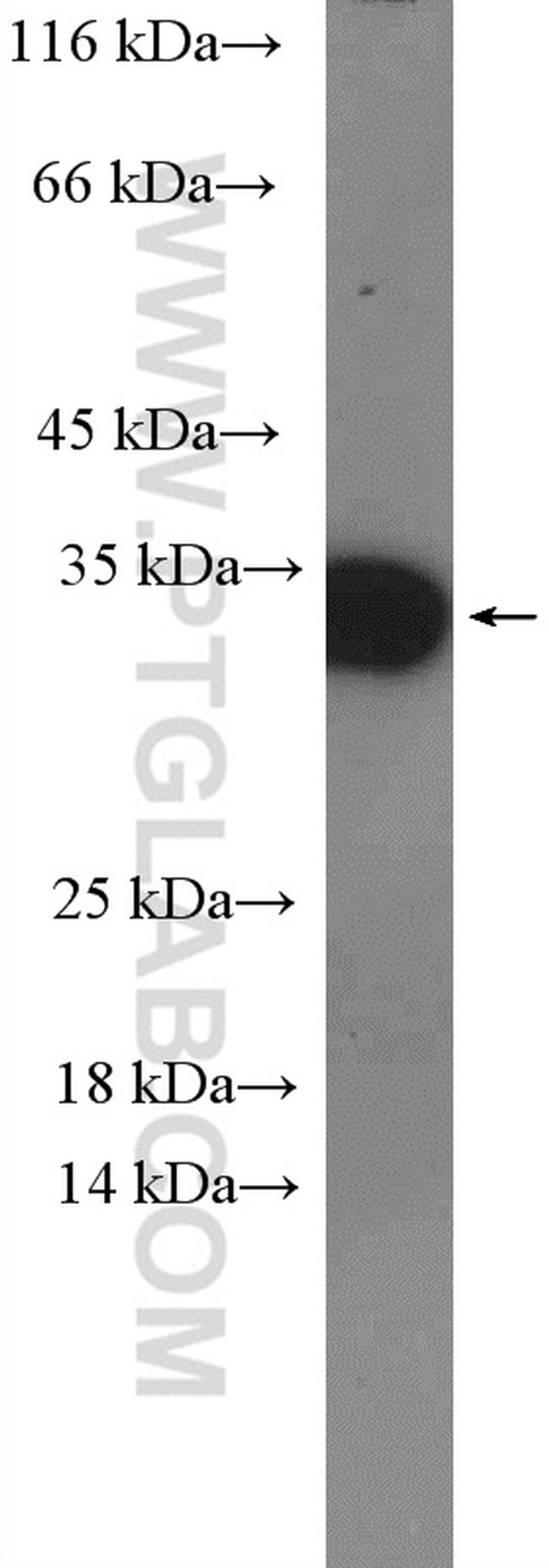 TSPAN9 Antibody in Western Blot (WB)