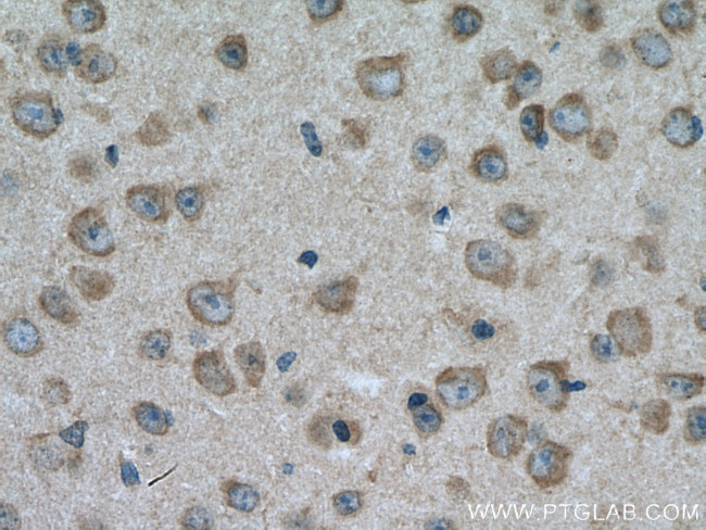 TRPM4 Antibody in Immunohistochemistry (Paraffin) (IHC (P))