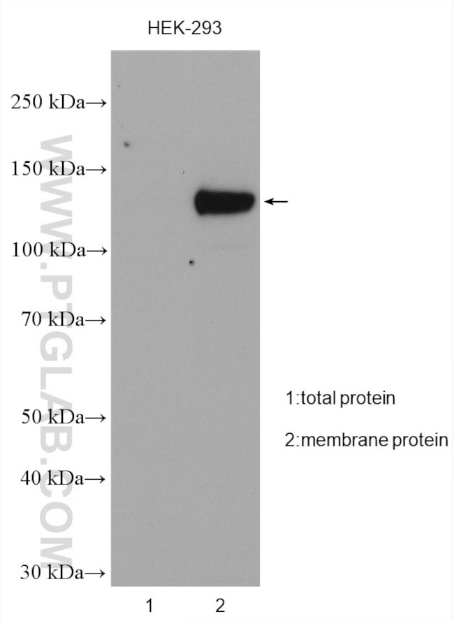 TRPM4 Antibody in Western Blot (WB)