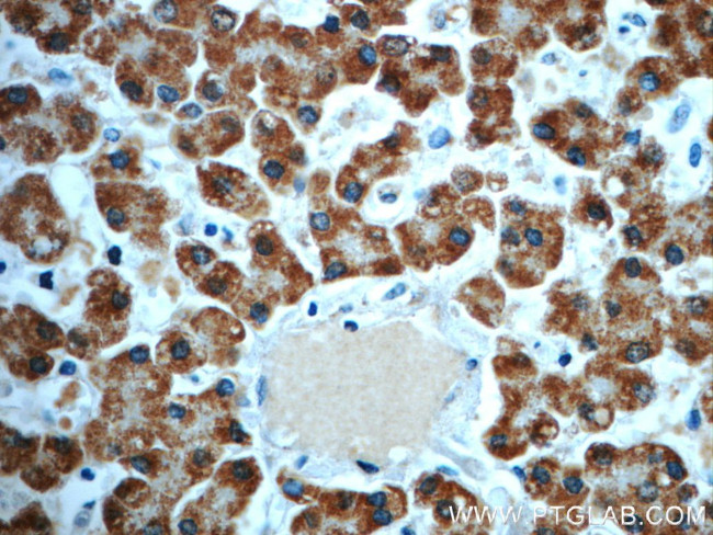 PCCA Antibody in Immunohistochemistry (Paraffin) (IHC (P))