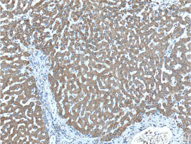 PCCA Antibody in Immunohistochemistry (Paraffin) (IHC (P))