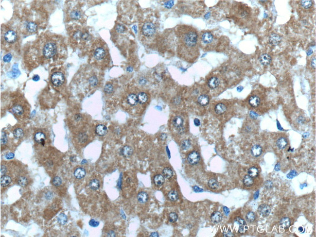 PCCA Antibody in Immunohistochemistry (Paraffin) (IHC (P))