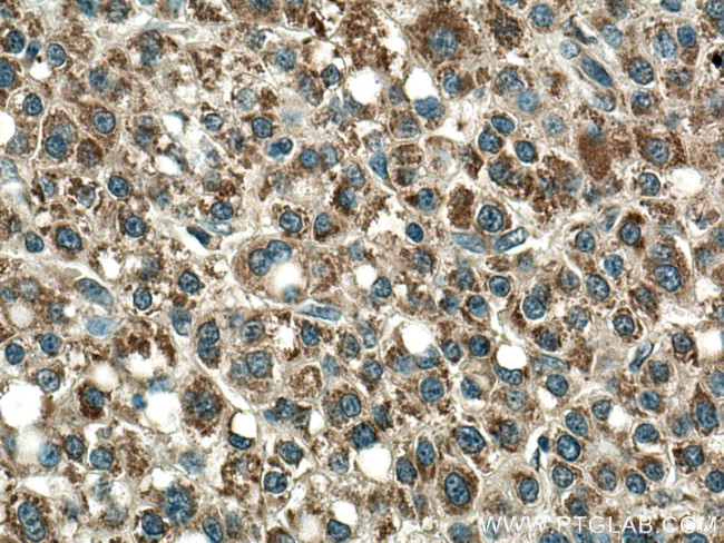 PCCA Antibody in Immunohistochemistry (Paraffin) (IHC (P))