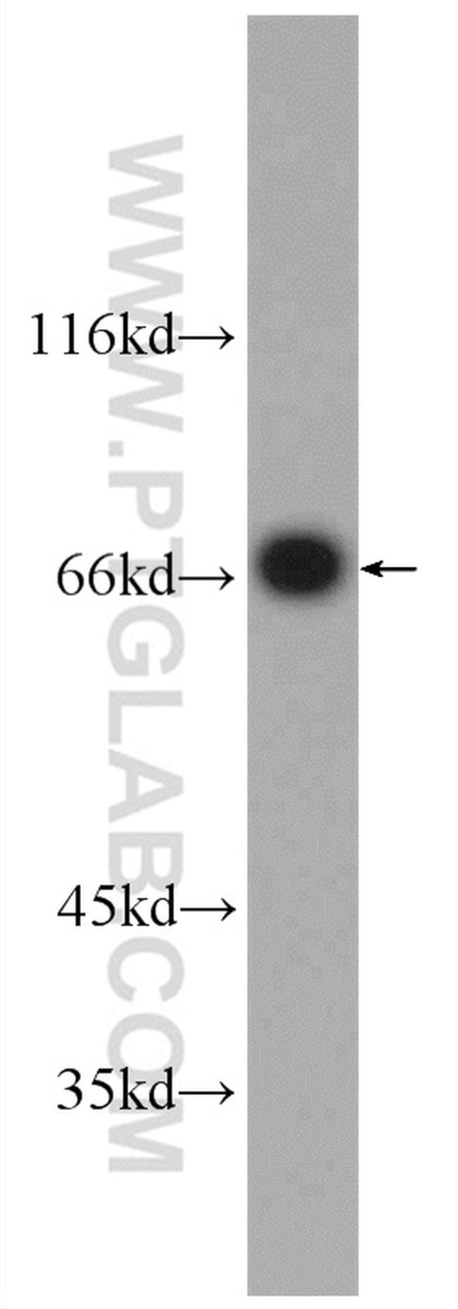 PCCA Antibody in Western Blot (WB)