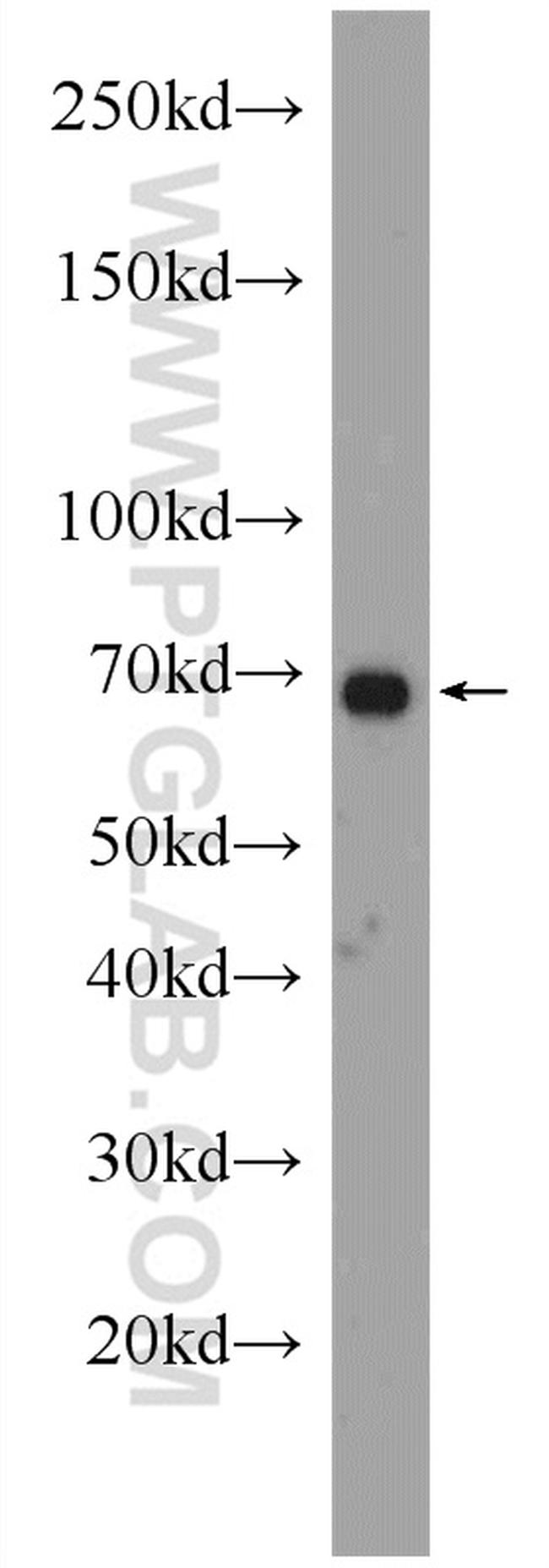 PCCA Antibody in Western Blot (WB)