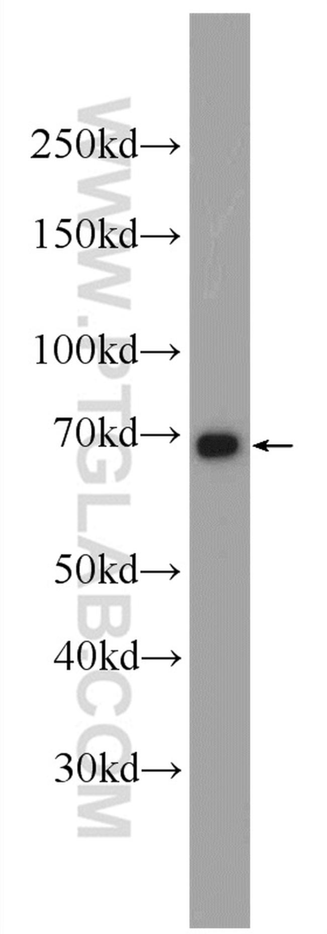 PCCA Antibody in Western Blot (WB)