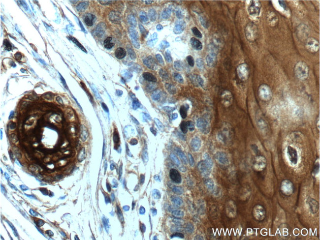 Annexin A1 Antibody in Immunohistochemistry (Paraffin) (IHC (P))