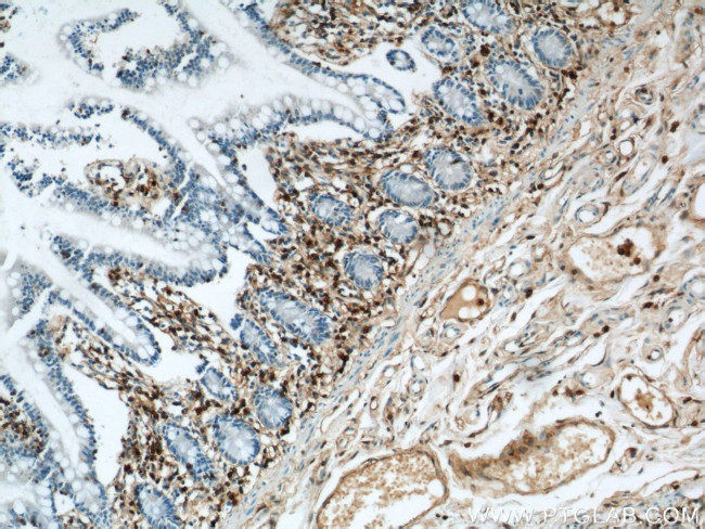 Annexin A1 Antibody in Immunohistochemistry (Paraffin) (IHC (P))