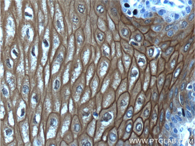 Annexin A1 Antibody in Immunohistochemistry (Paraffin) (IHC (P))