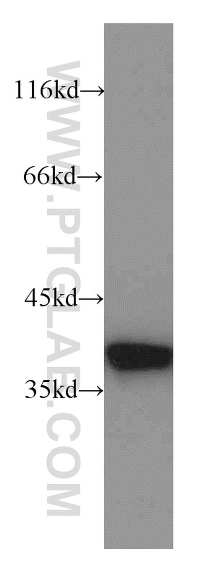 Annexin A1 Antibody in Western Blot (WB)