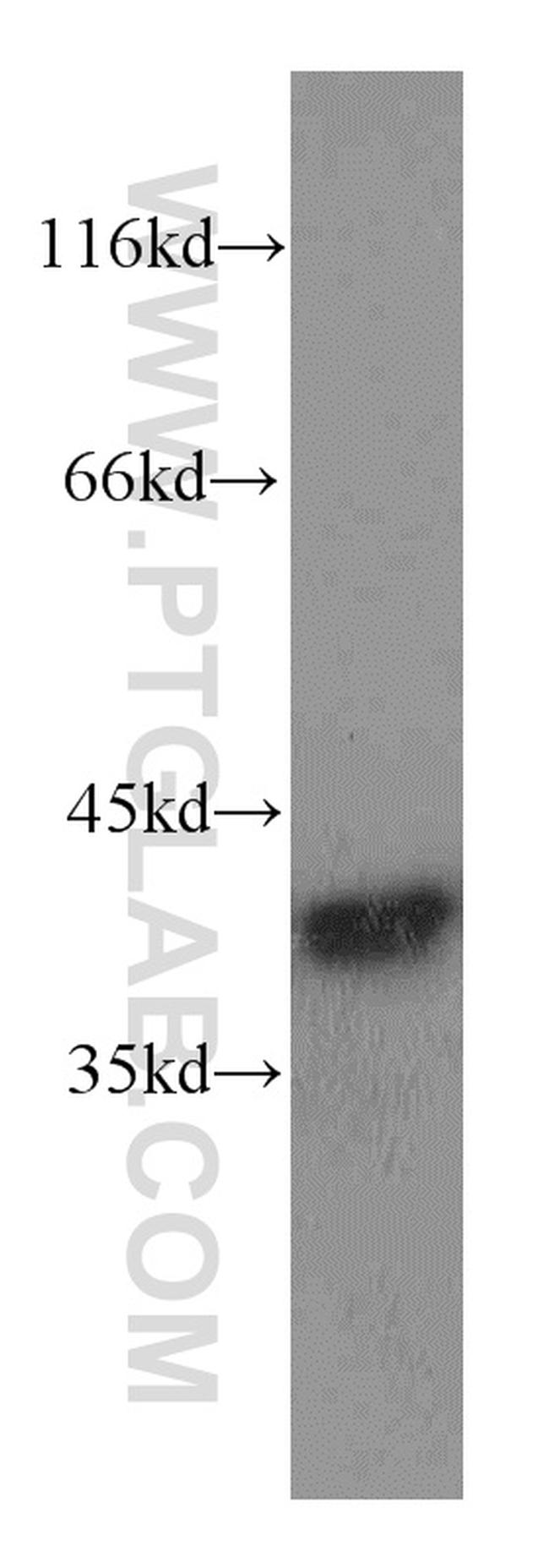 Annexin A1 Antibody in Western Blot (WB)