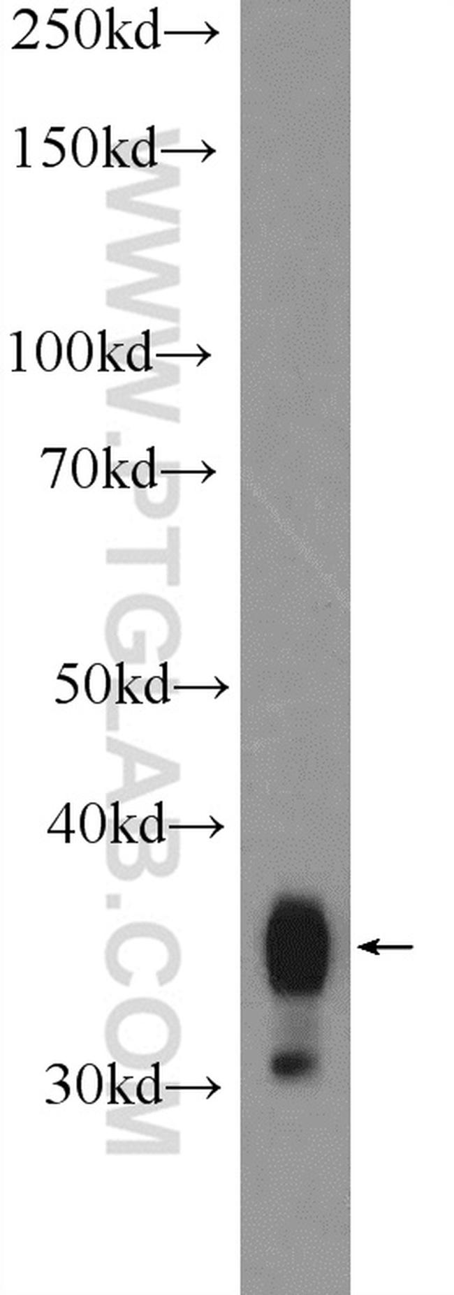 Annexin A1 Antibody in Western Blot (WB)