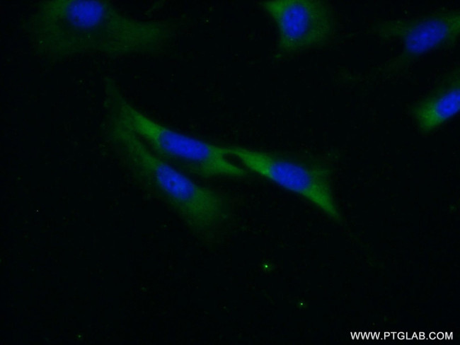 PKC alpha Antibody in Immunocytochemistry (ICC/IF)