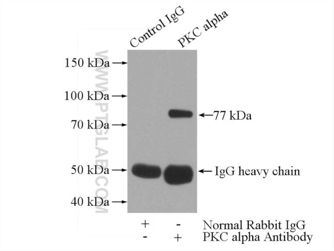 PKC alpha Antibody in Immunoprecipitation (IP)