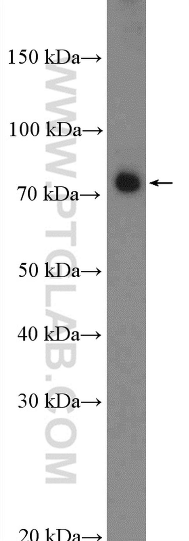 PKC alpha Antibody in Western Blot (WB)